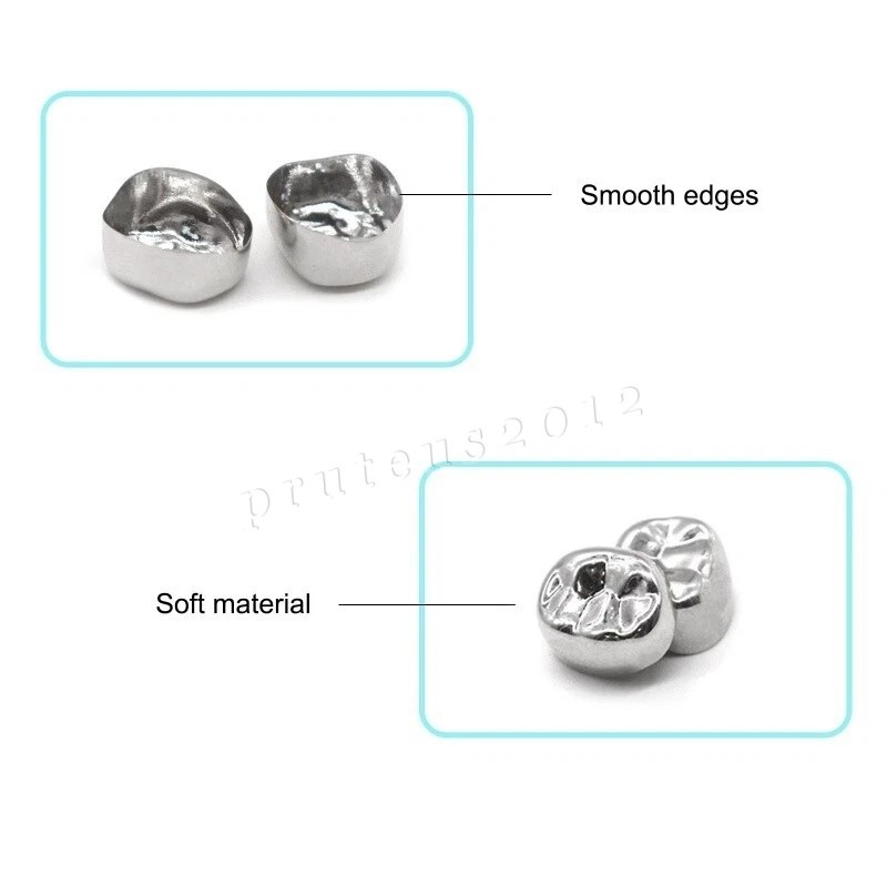 Dental Material Children’s Stainless Steel Baby Teeth Prefabricated Crown 48/Box