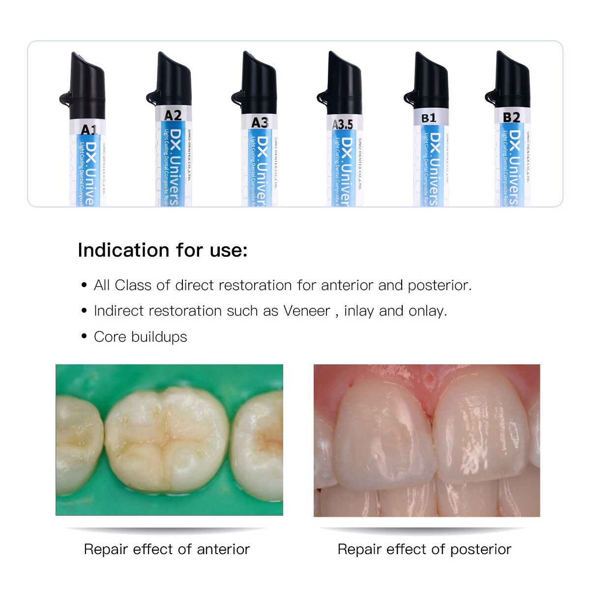 Dental Resina Fotopolimerizable Esmalte Dentinario /Adhesivo Visible /37% Ácido
