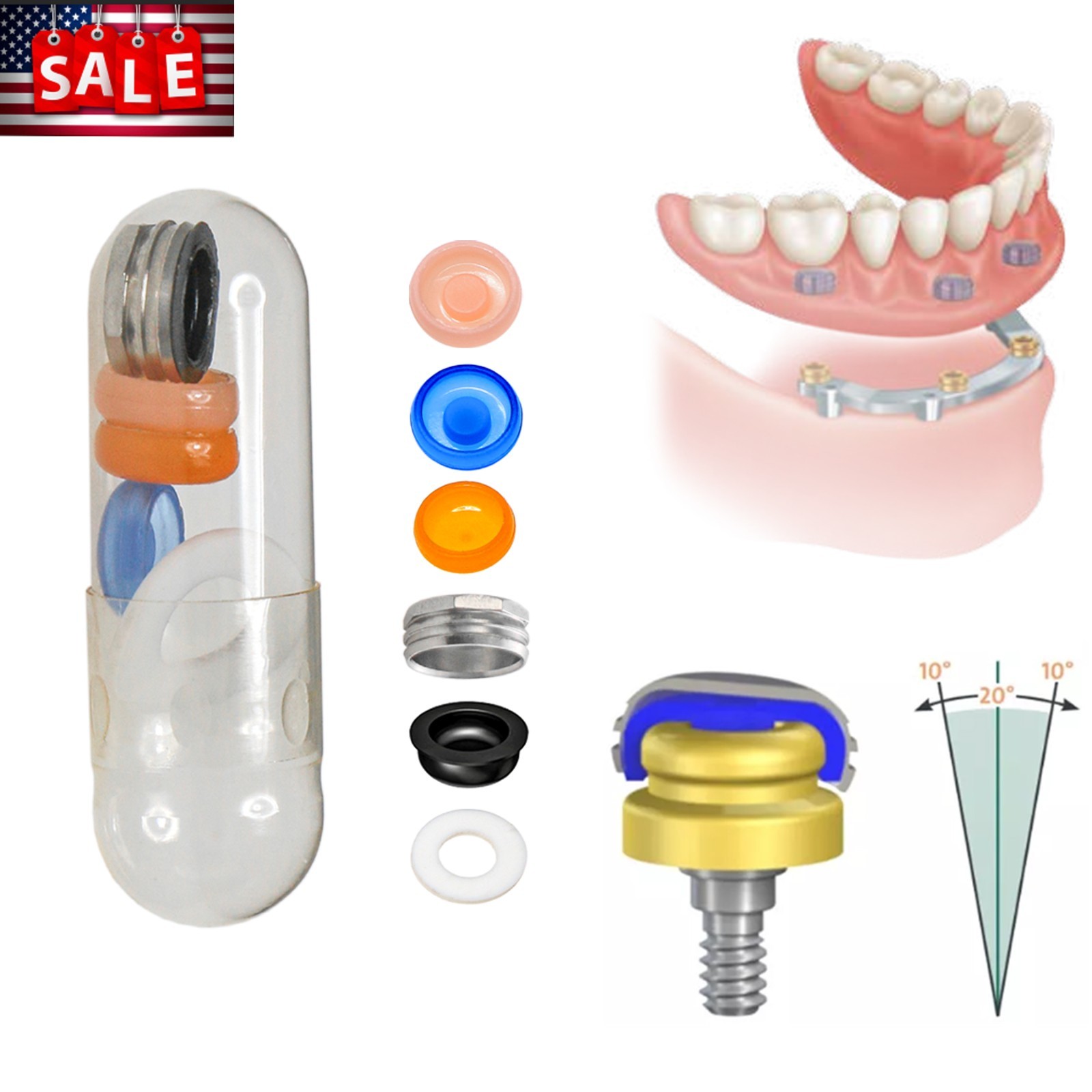 For Neodent Grand Morse GM LOCATOR Abutment PEEK w/Male Caps Inserts Overdenture