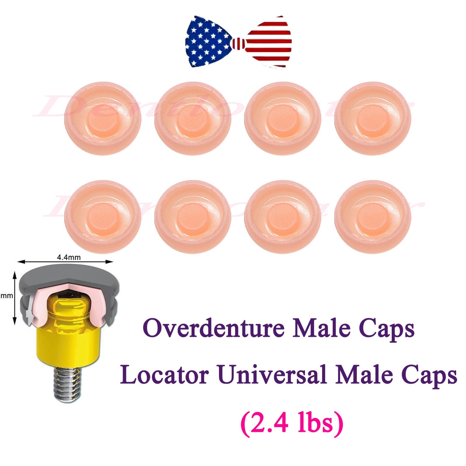 US Overdenture Attachment Abutments Locator Male Caps Pink 2.4lbs Replacement