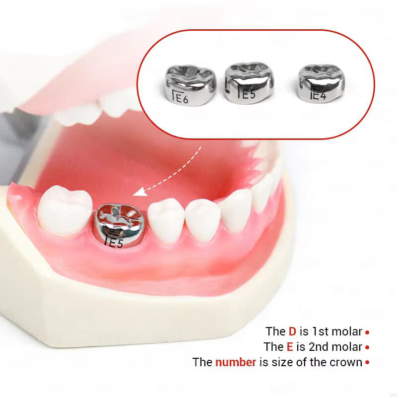 Dental Stainless Steel Primary Pediatric Pedo Molar Crowns Baby Kids Teeth Crown