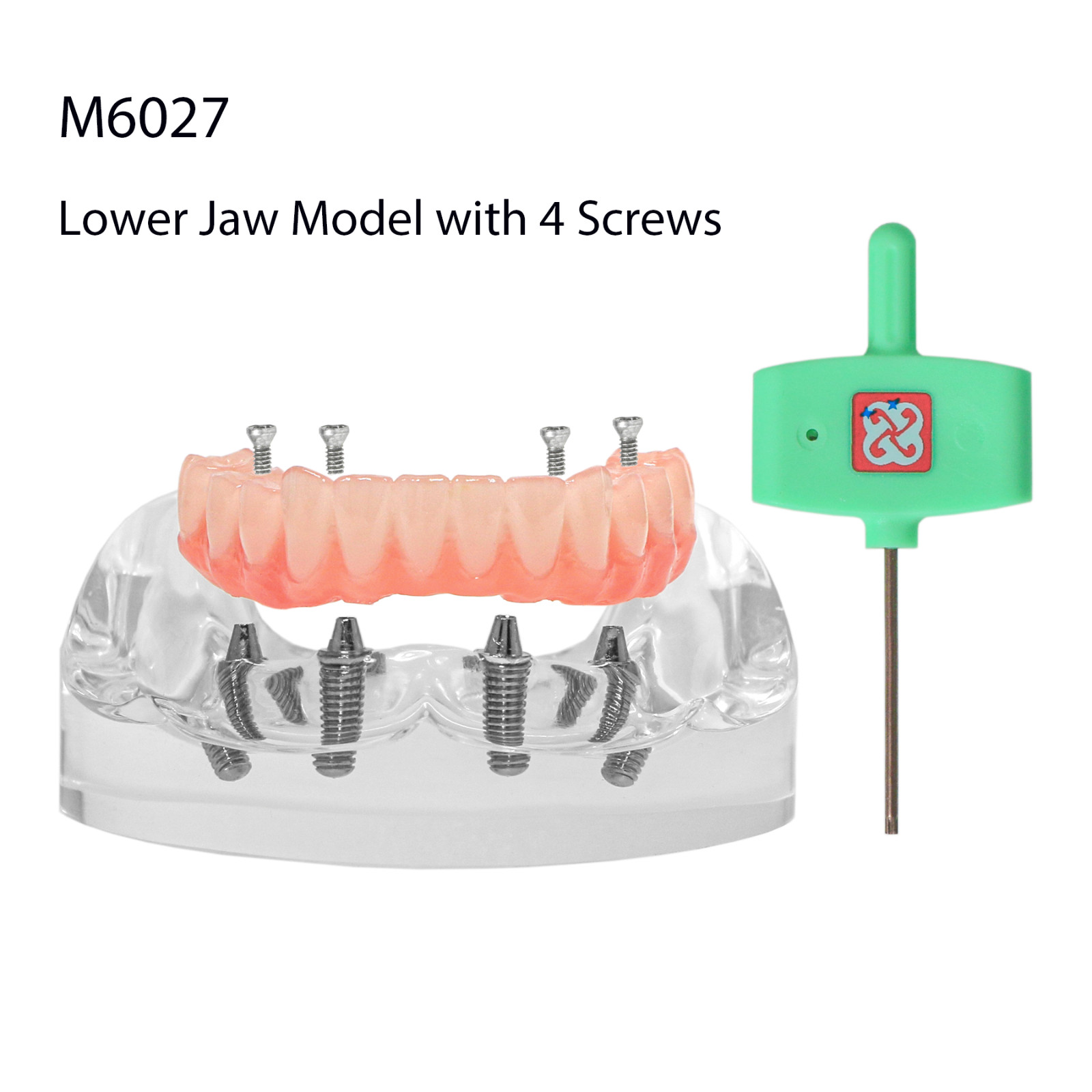 US Dental Overdenture All-on-4/6 Upper/Lower Jaw Teeth Model with 4/6 Screws