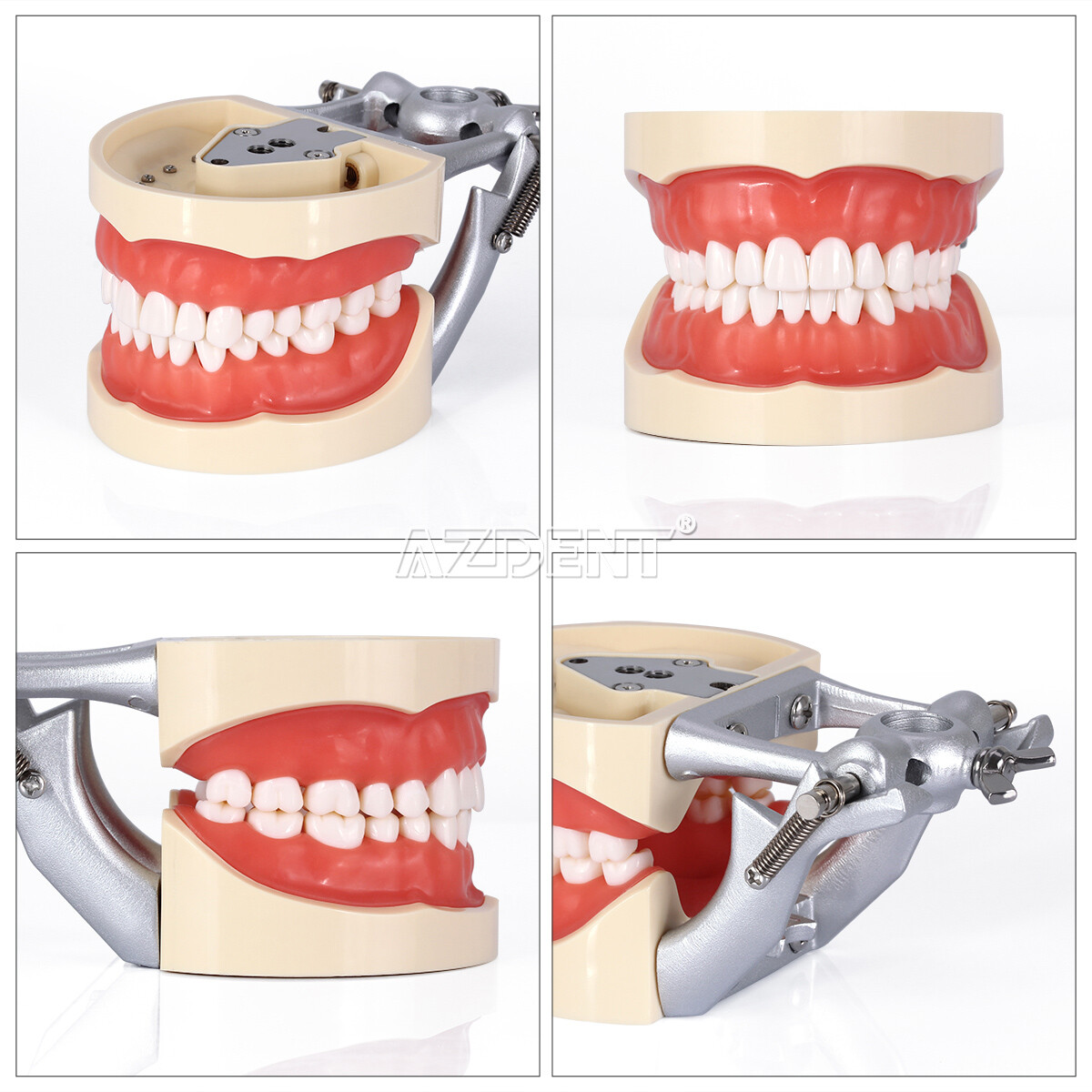 Dental Implant Teeth Model U/ L Demo Overdenture Restoration w/ 2 4 Implants