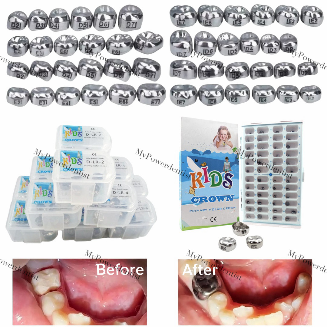 Dental Kids Primary Molar Crown Stainless Steel Kit/Refill 48Size