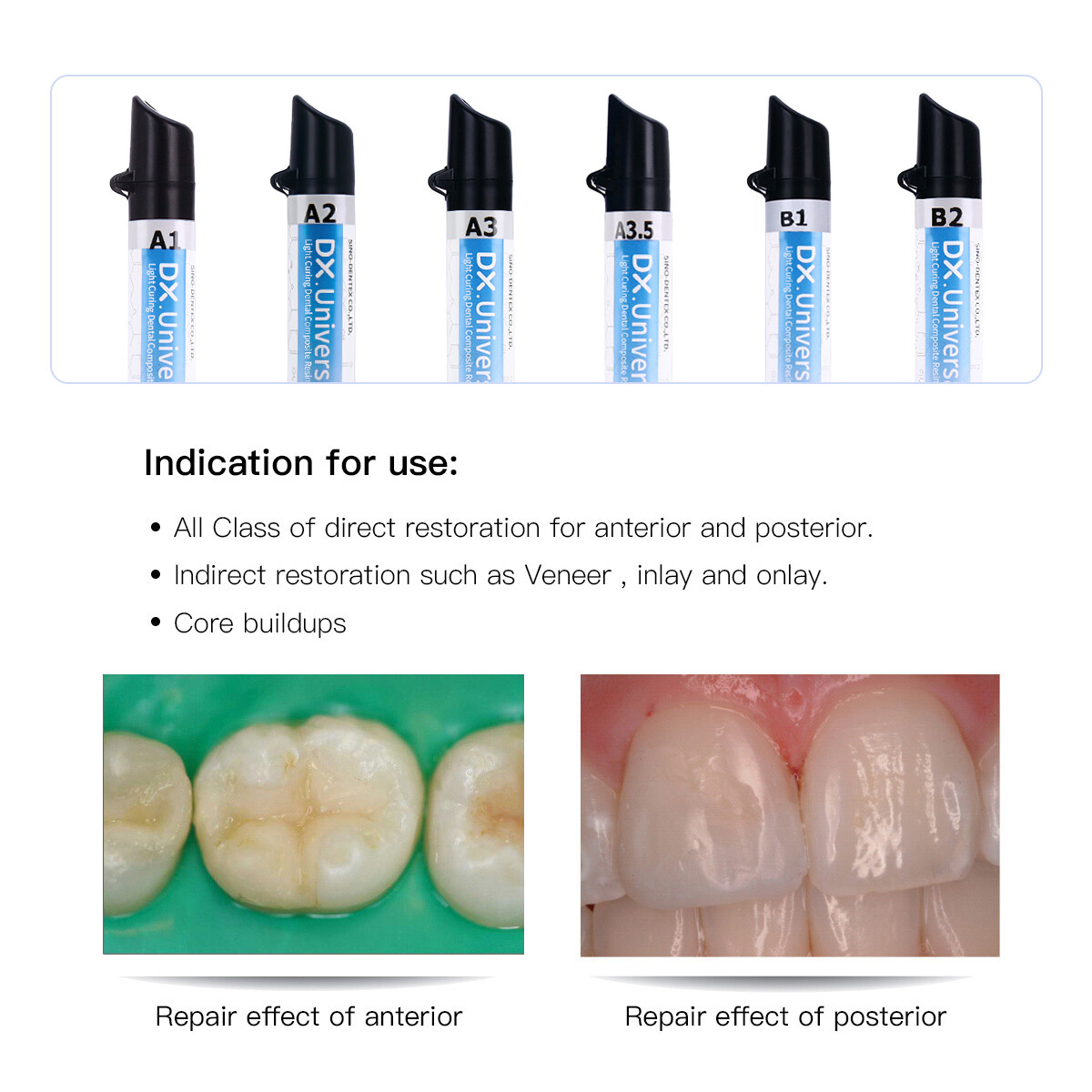 Dental Universal Light Cure Hybrid/Enamel/Flowable/Medium Flow Composite Resin