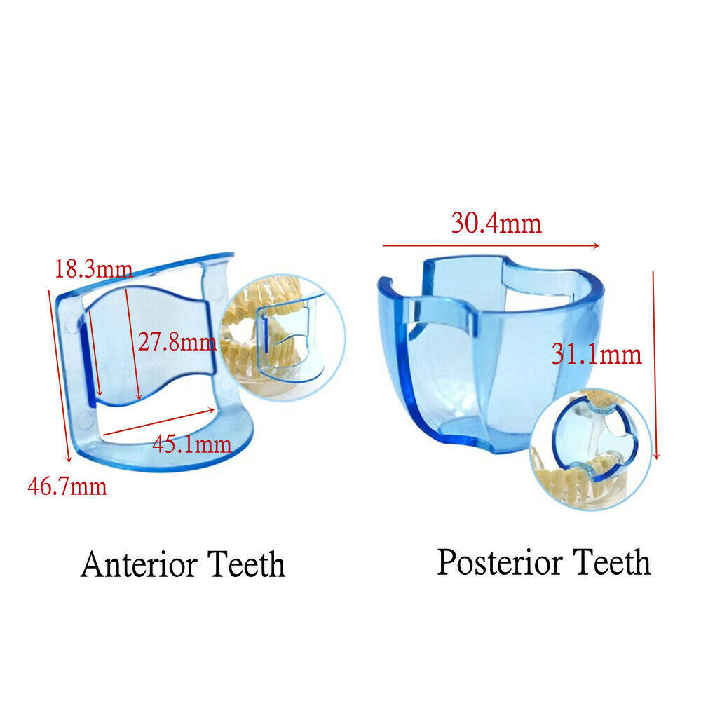 Dental Anterior/Posterior Mouth Opener Bite Prop Lip Retractor Cheek Expander