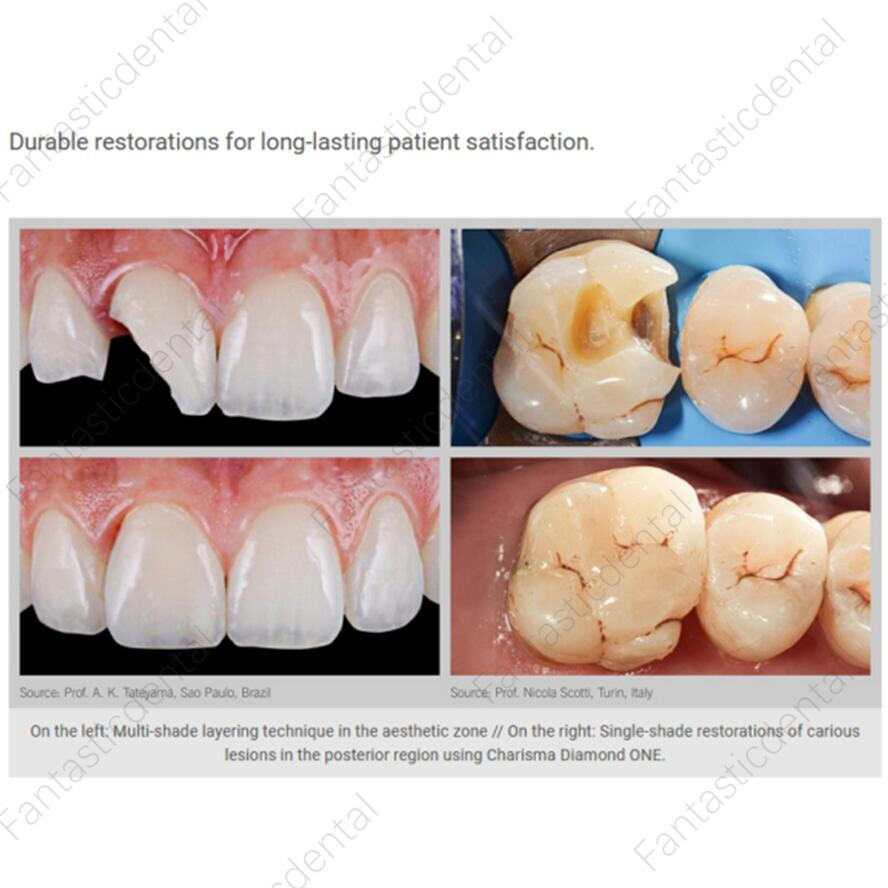 Dental KULZER CHARISMA Diamond OB Light Cure Composite Resin BL BXL Super White