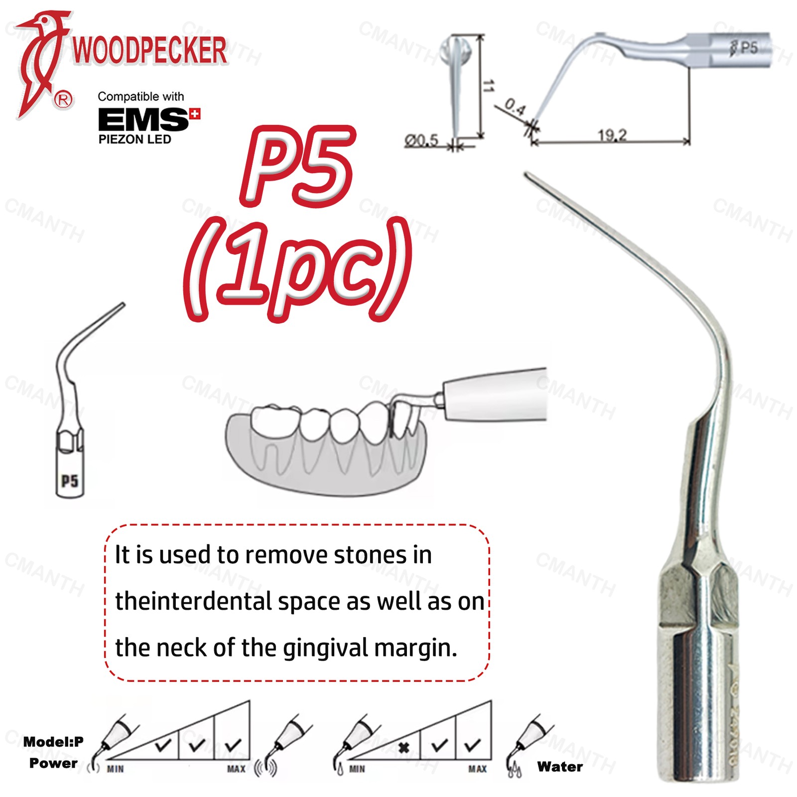 Woodpecker Dental Ultrasonic Scaler Tips Periodontics Tip Fit EMS USD Handpiece