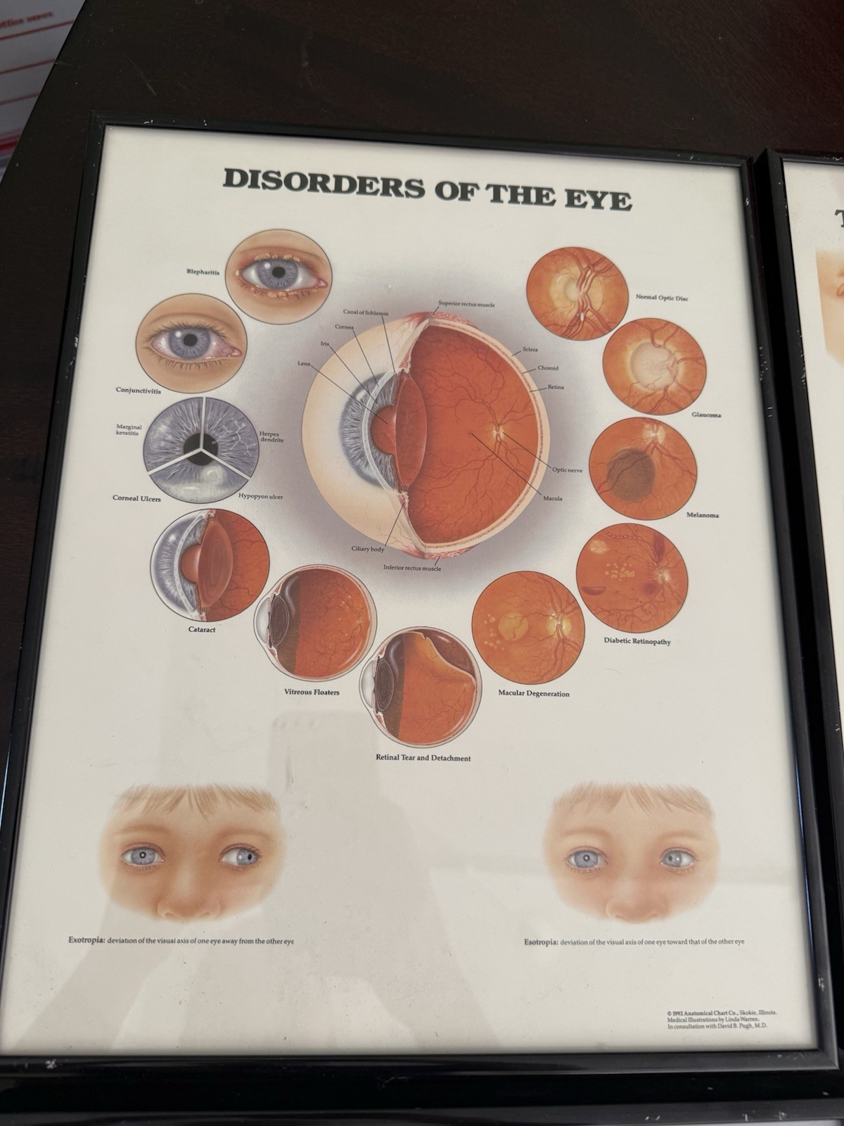 Vintage Anatomical Chart Company Framed Eye Art – 1986-92 – Set of 4 – Optometry