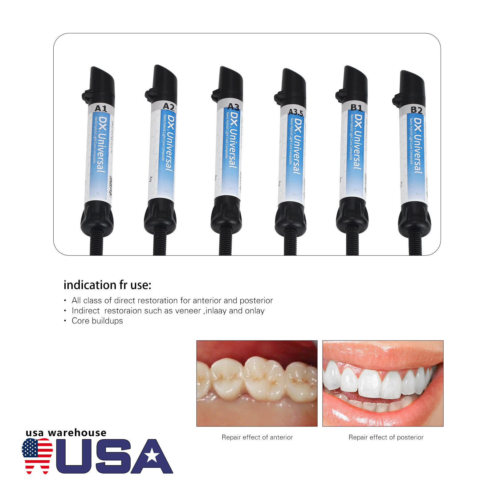 Dental Composite Resin Light Cure Bonding Agent Acid Etching Gel A1 – A3.5 B1