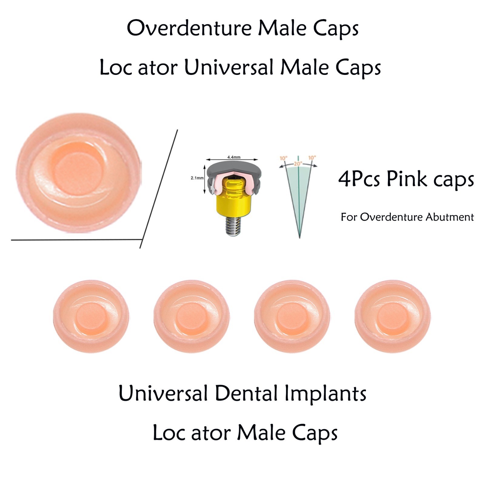 US ZEST Locator Replacement Retention Male Caps Inserts For Dental Overdenture
