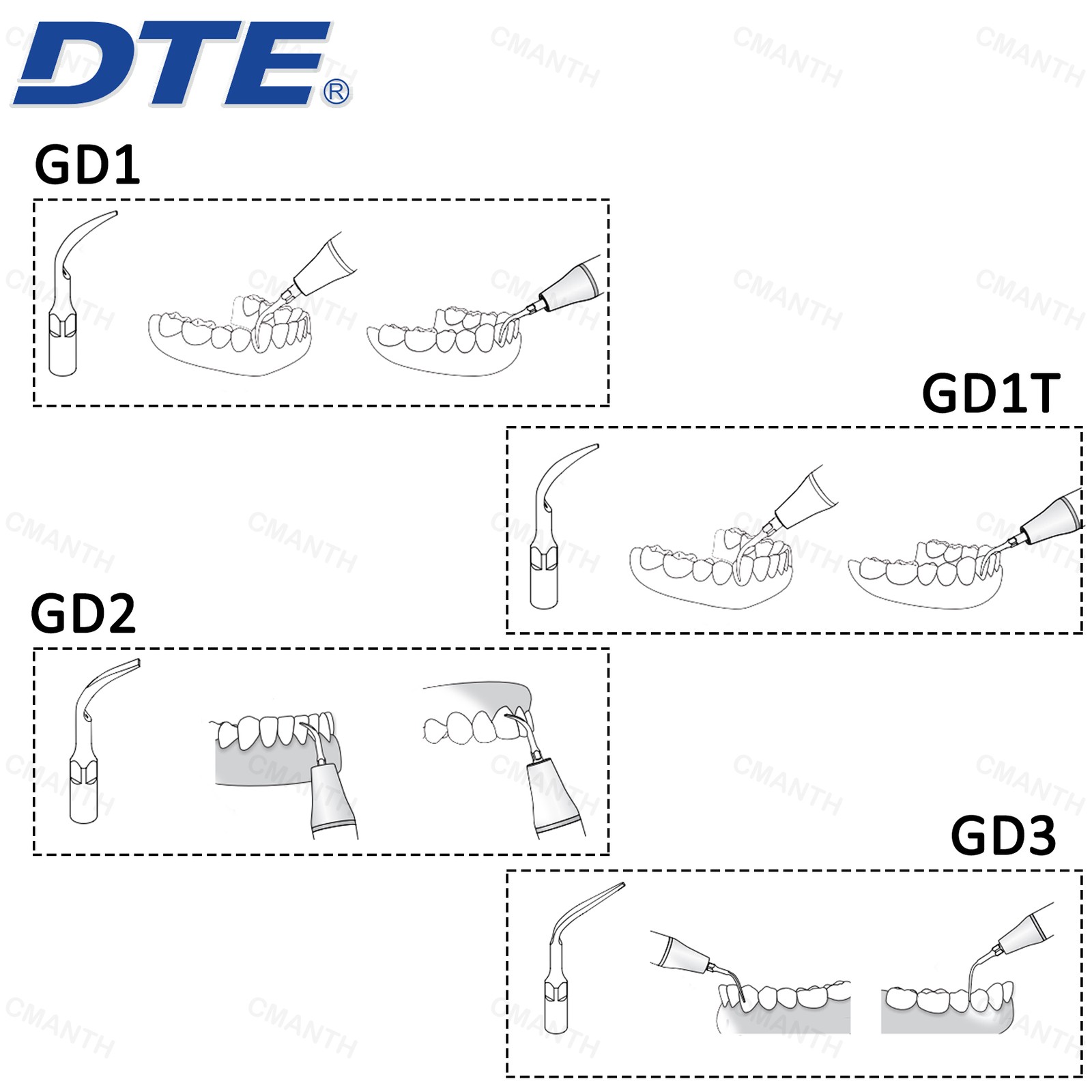 Woodpecker DTE Dental Ultrasonic Scaler Tips GD-Series Fit SATELEC ACTEON NSK
