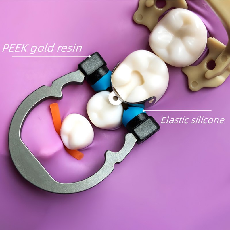 Dental Matrix Bands Ring Sectional Matrice Clamp Fit Garrison Palodent V3 System