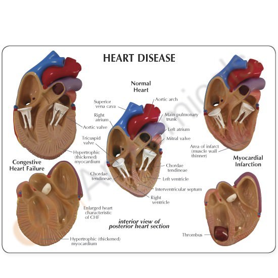 Mini Heart Set of 3 GPI Anatomical Models LFA#2550. Make Us an Offer . See VIDEO