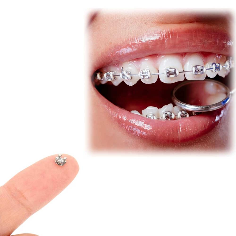 1pack Dental Orthodontic Brackets Braces Metal Monoblock （20Pcs/pack）