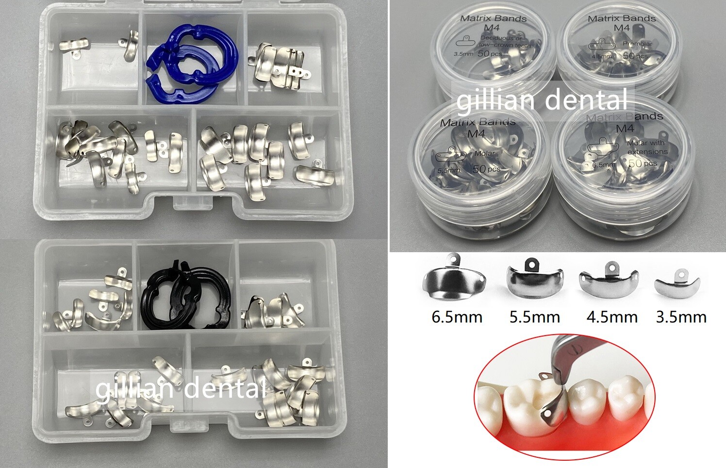 Dental Sectional Matrix Bands M4 3.5-6.5mm Metal Matrices Resin Clamp Clip Ring