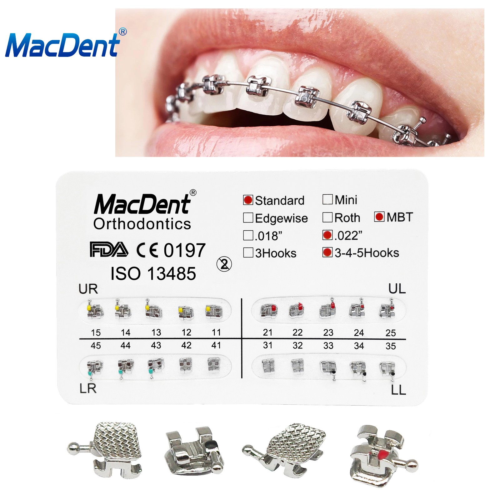 Dental Brackets /Orthodontic Light Cure Adhesive Kit/Blue Green Glue/Mini No-Mix