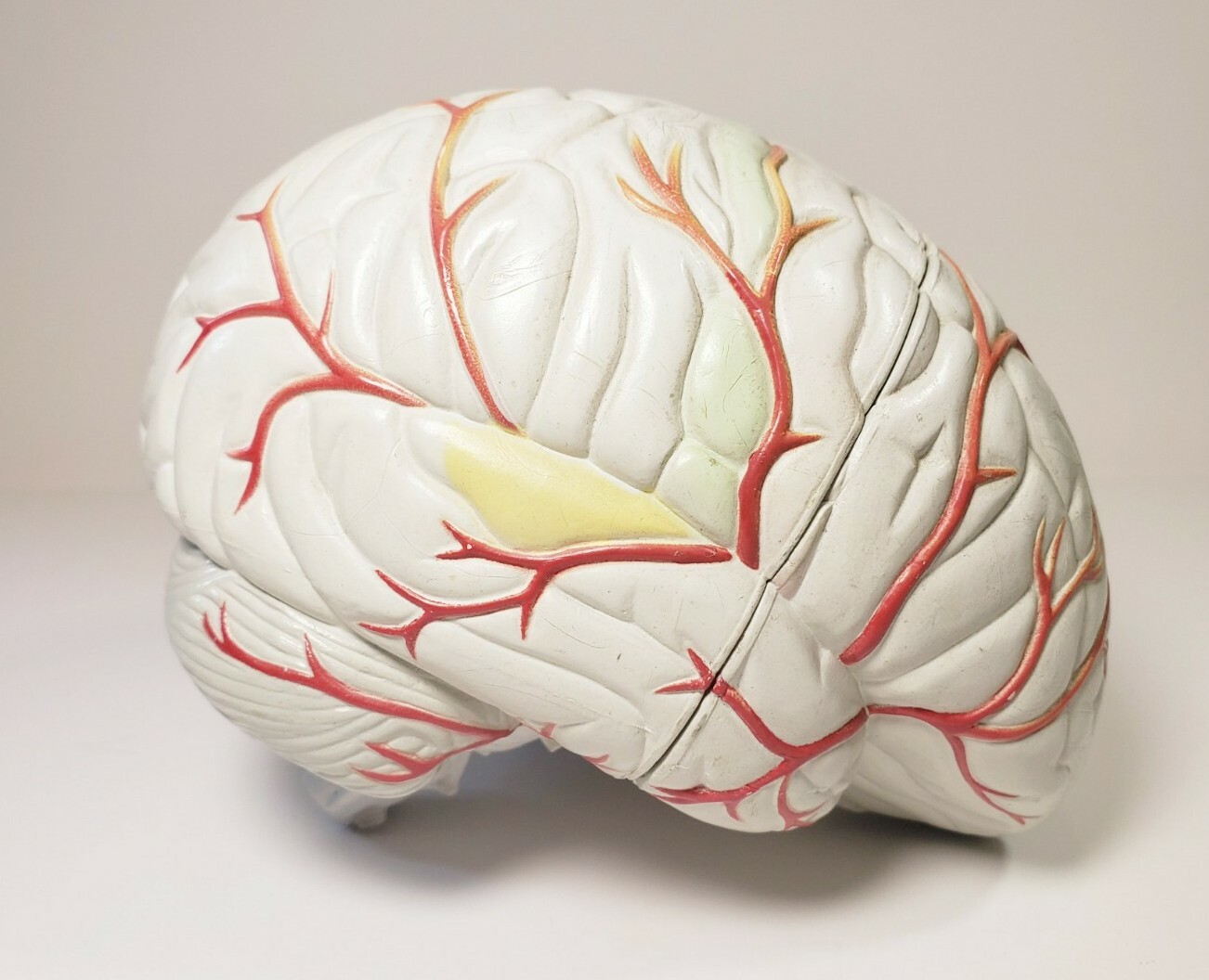 Human Brain Anatomical Teaching Model Life Size Medical Science Cross 4 Sections