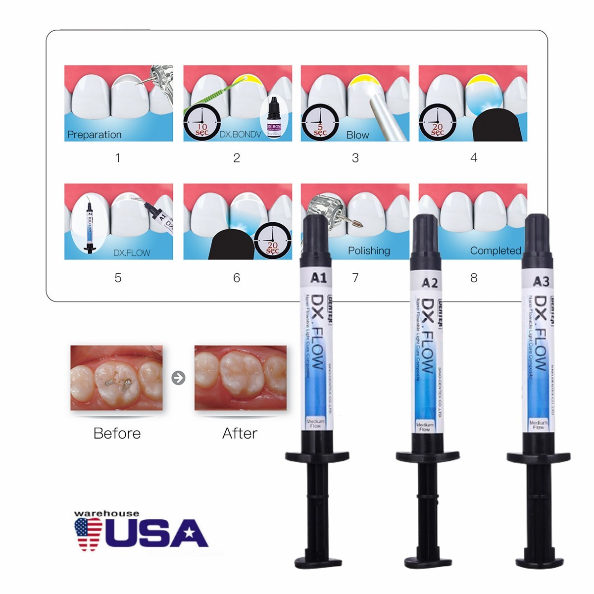 DENTEX Flowable Light Cure Composite Resin /Etching Gel/Bonding Adhesive
