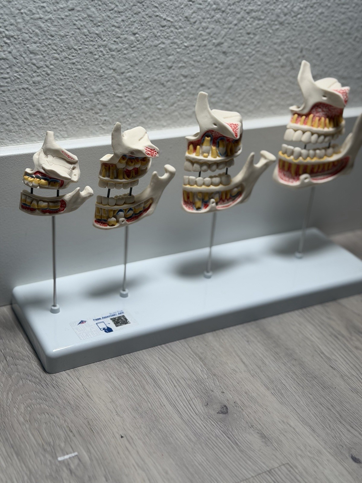 3B Scientific Dentition Development Model – 4 Stages Dental Teeth education