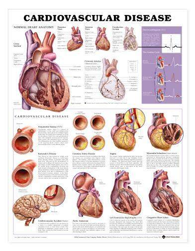 Cardiovascular Disease Wall Chart 20″ x 26″ Classroom/Professional LFA #99915