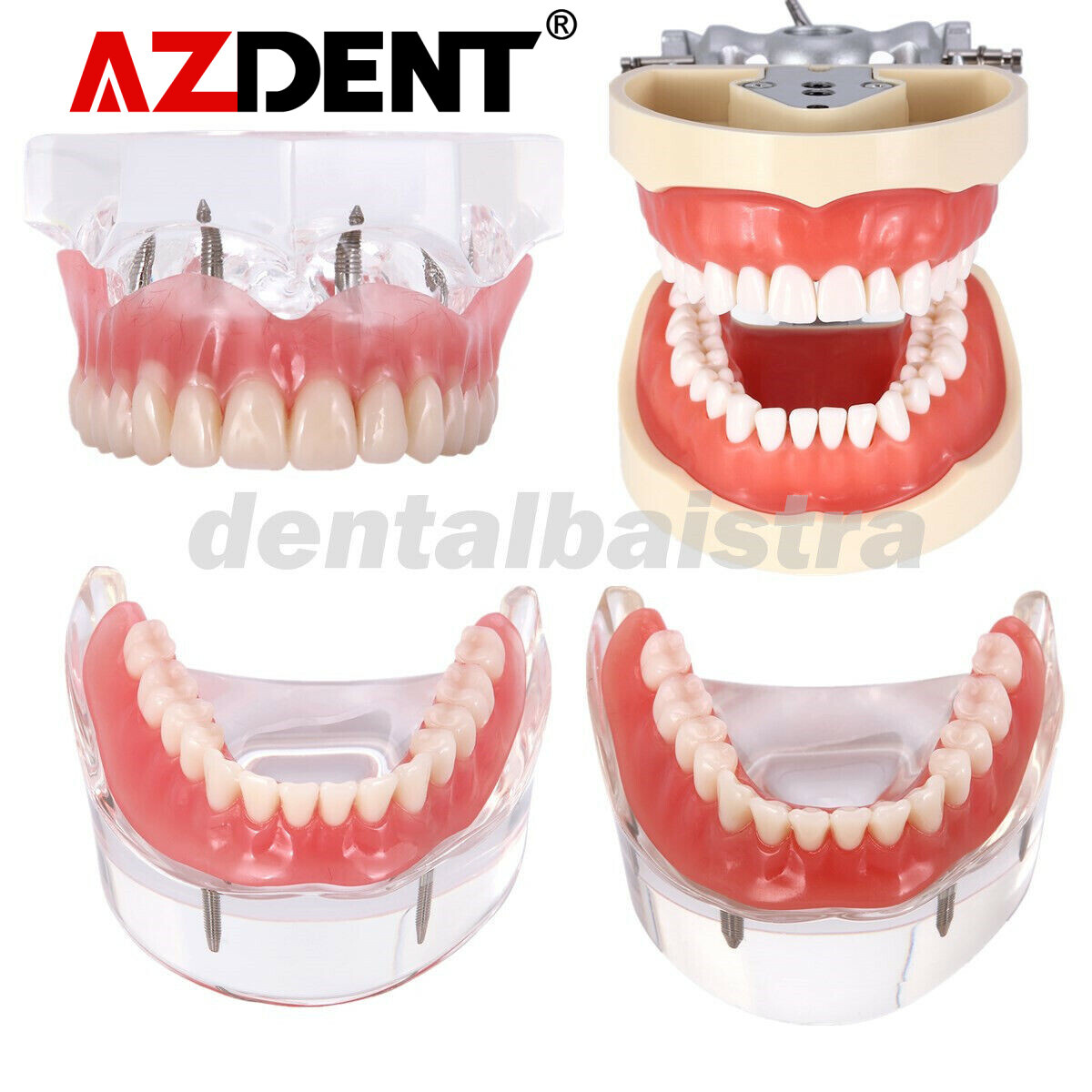 Dental Orthodontic Typodont Model /Implant Denture Restoration Model