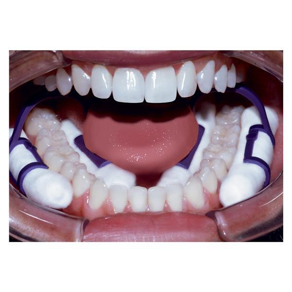 Pascal 28-100 Isolator Cotton Roll Dental Holder Purple Disposable 50/Bx