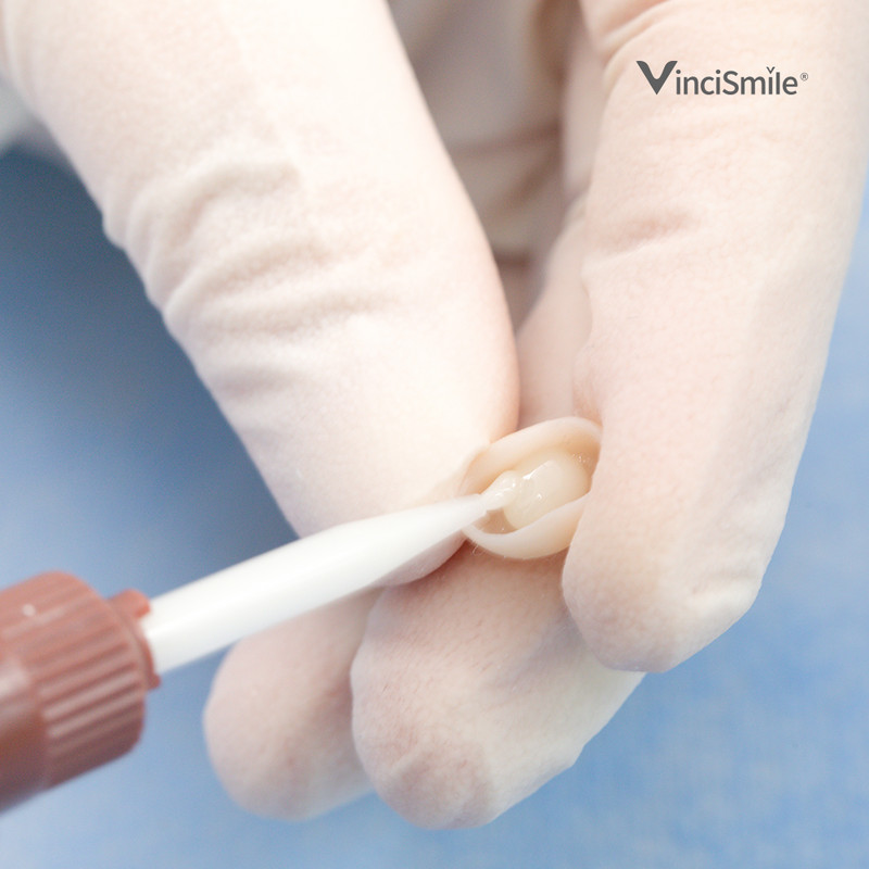 TopCEM-Veneer Dental Light Cure Veneer Cement 2.5g