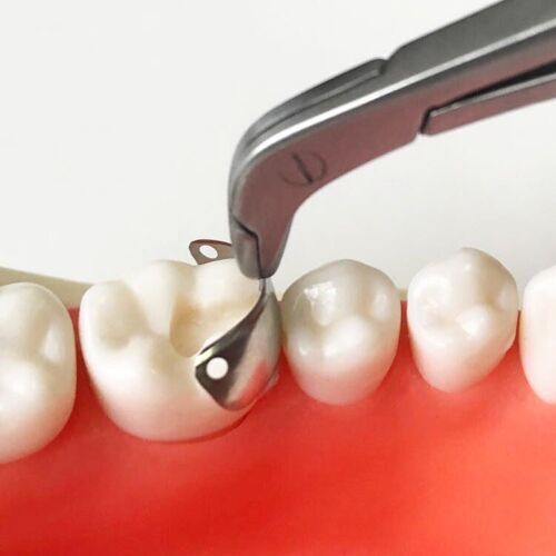50 Pcs Dental Matrix Bands Palodent V3 Style Sectional Contoured Matrices Refill