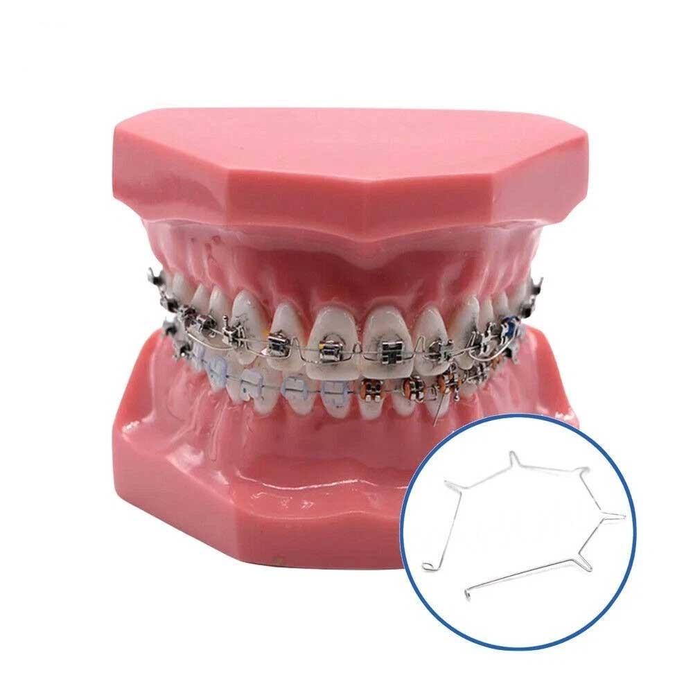 Dental Orthodontic Anterior Root Torquing Auxiliary Arch 5Pcs/Pack