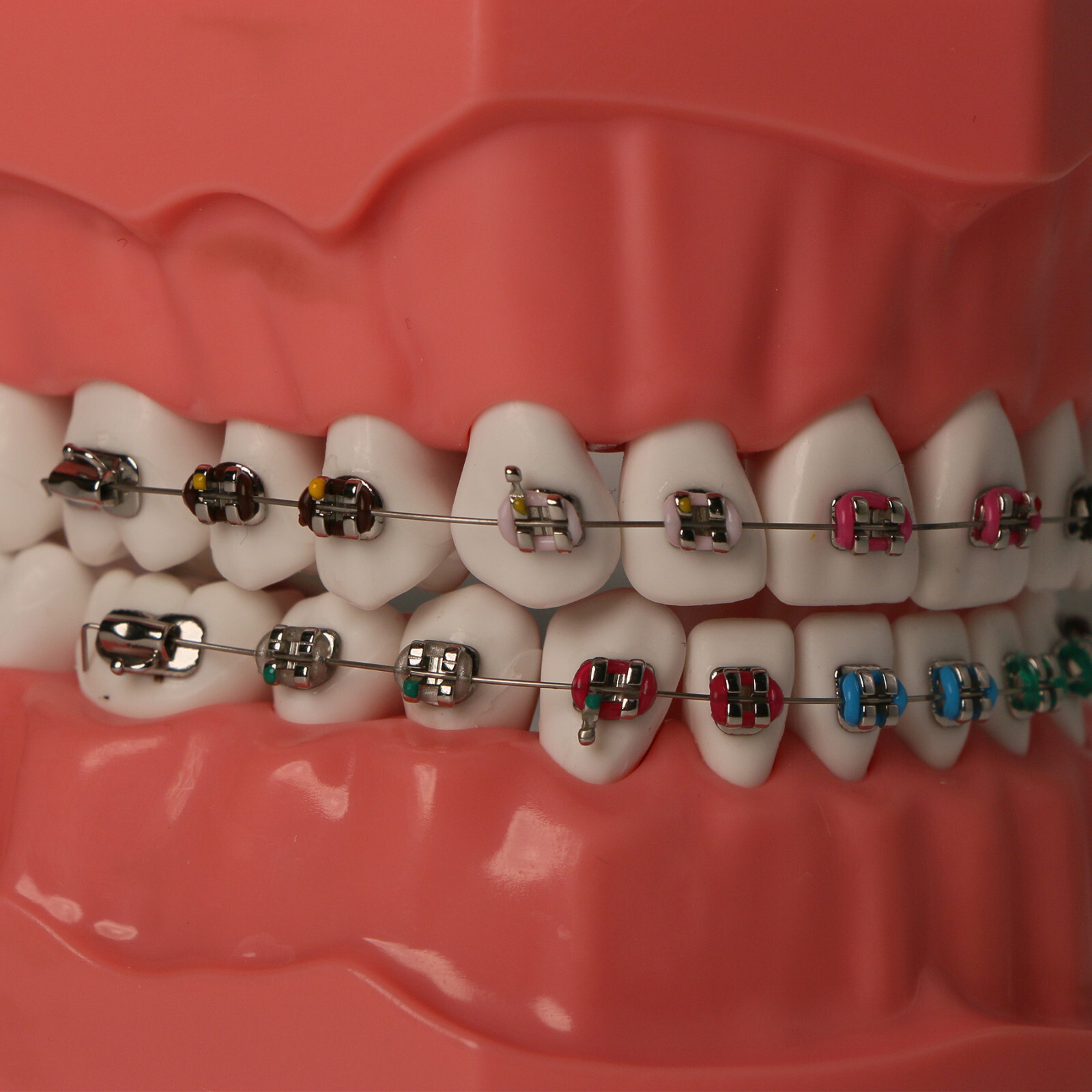 US Dental 1:1 TypodontTeeth Model Orthodontic with Metal Brackets Brace M7010-2