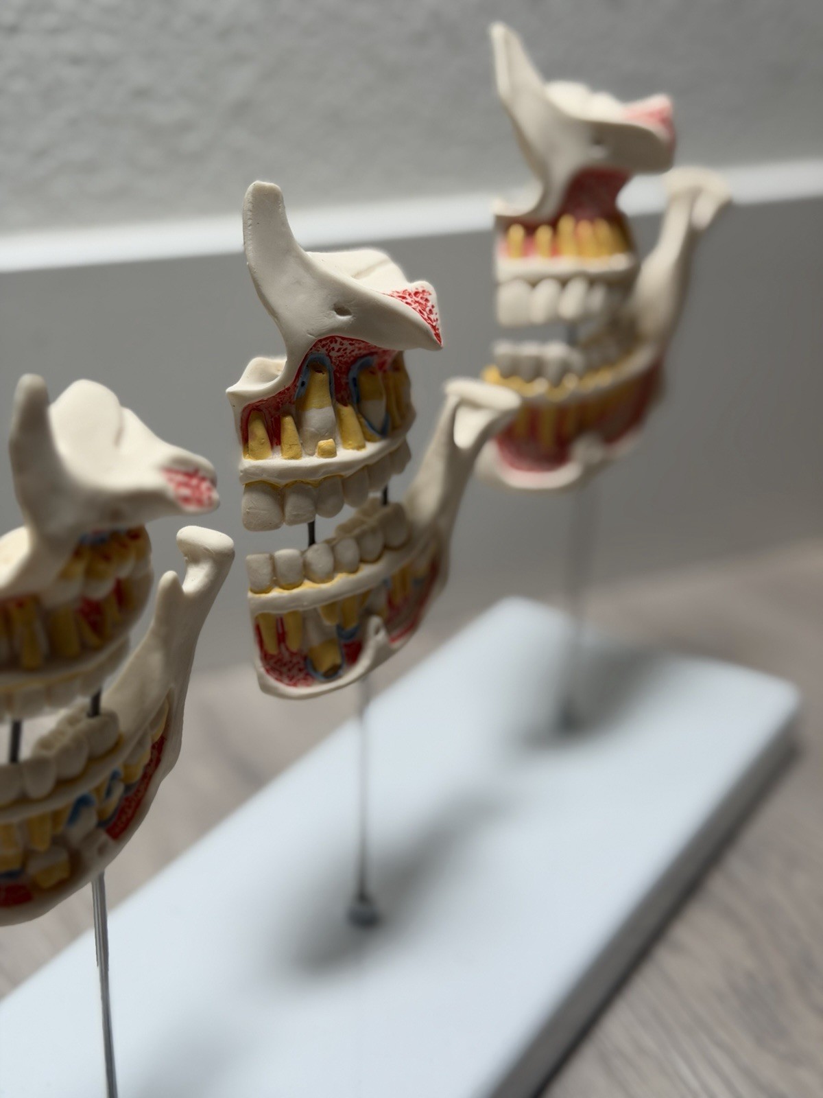 3B Scientific Dentition Development Model – 4 Stages Dental Teeth education