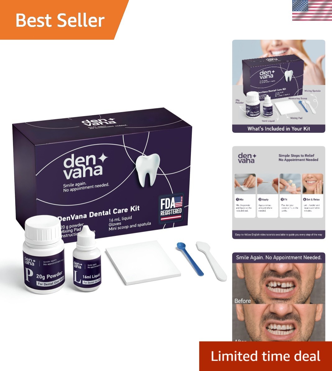 Dental Cement Kit – Zinc Oxide Eugenol Temporary Filling & Crown Repair | Too…