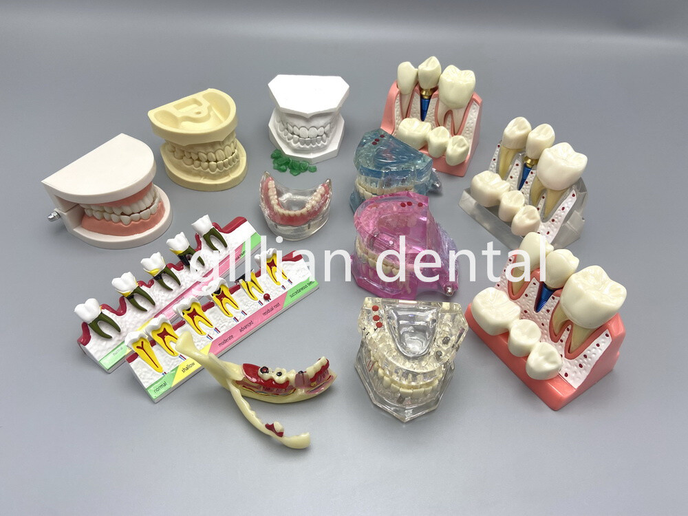 Dental Model Teeth Implant Restoration Bridge Teaching Study Medical Science