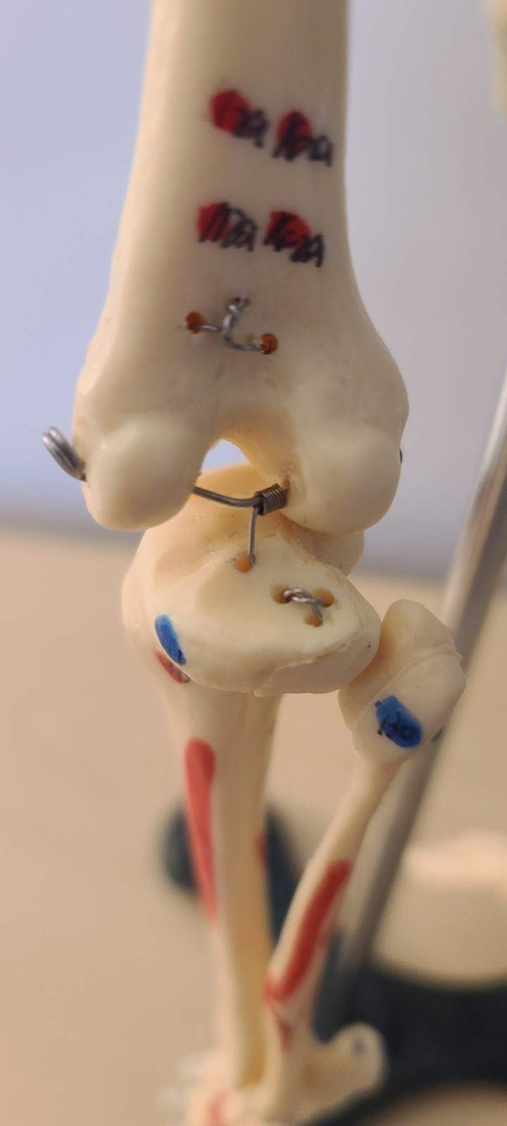 VINTAGE MEDICAL MODEL 27″ SKELETON ON METAL STAND