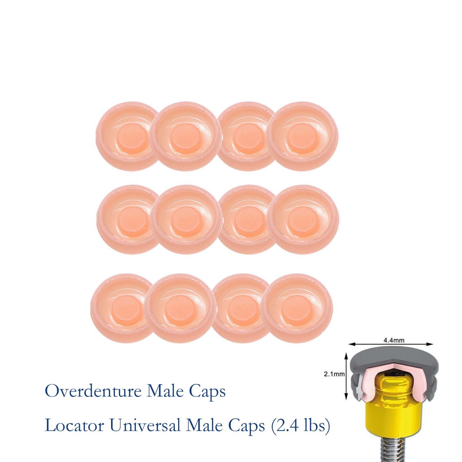 US Dental fit ZEST locator Male Cap Inserts Standard Angle Range 20°-1.2/2.4lbs