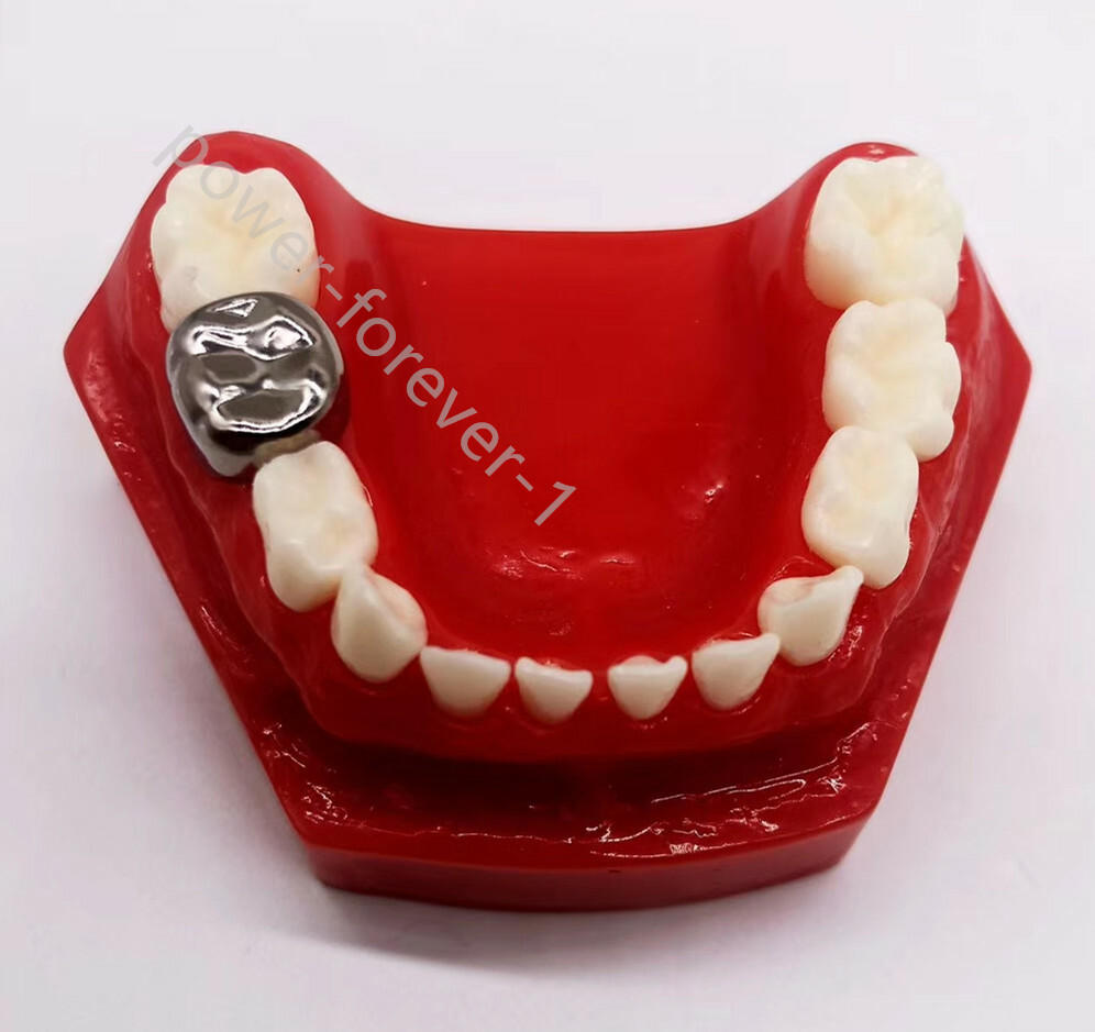 5pcs/box Dental Kids Crown Protect Teeth Primary Molar Stainless Steel Pediatric