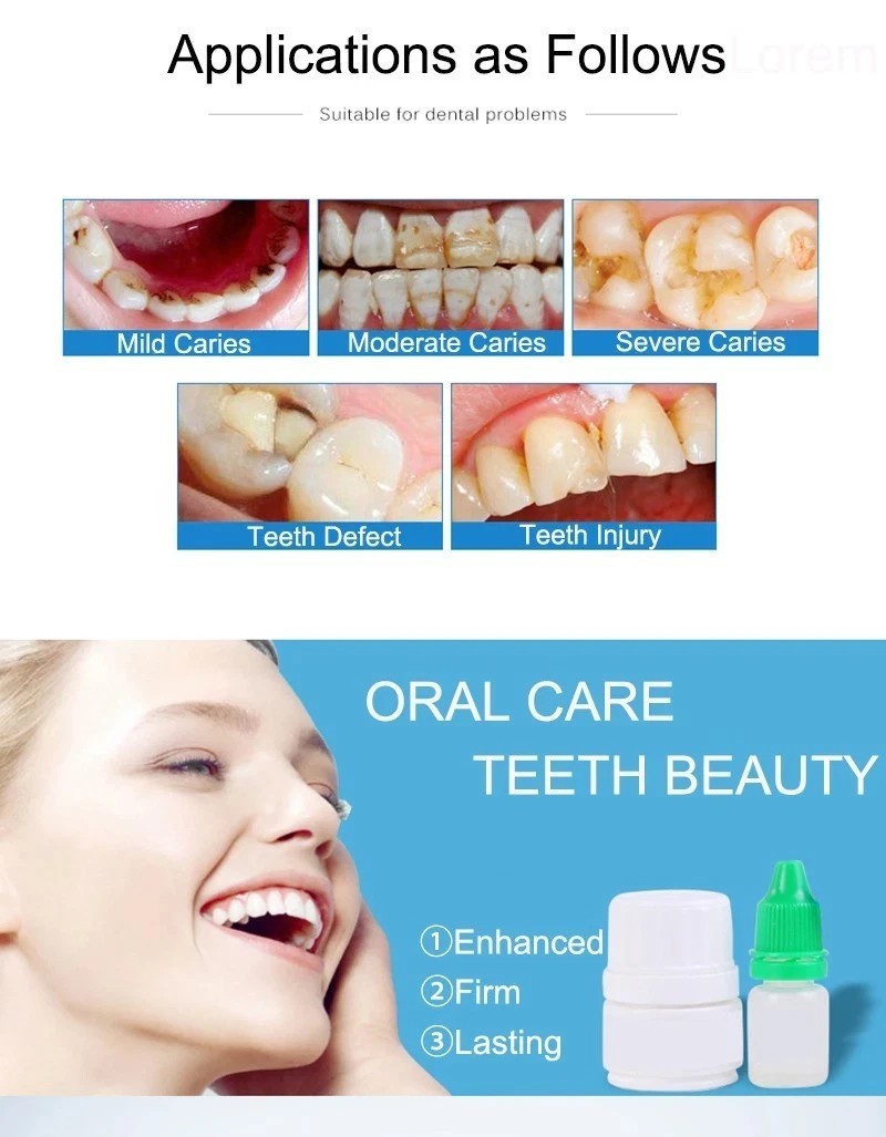 Dental Cement Permanent Tooth Filling Fixation Powder Liquid resin glue teeth