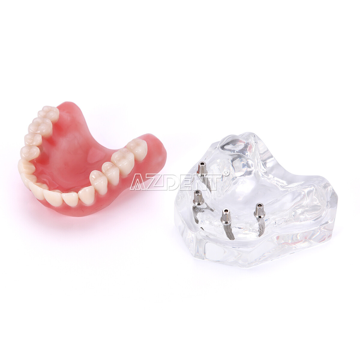 Implante dental Dientes Modelo Demo Sobredentadura Restauración 2/4 Implantes