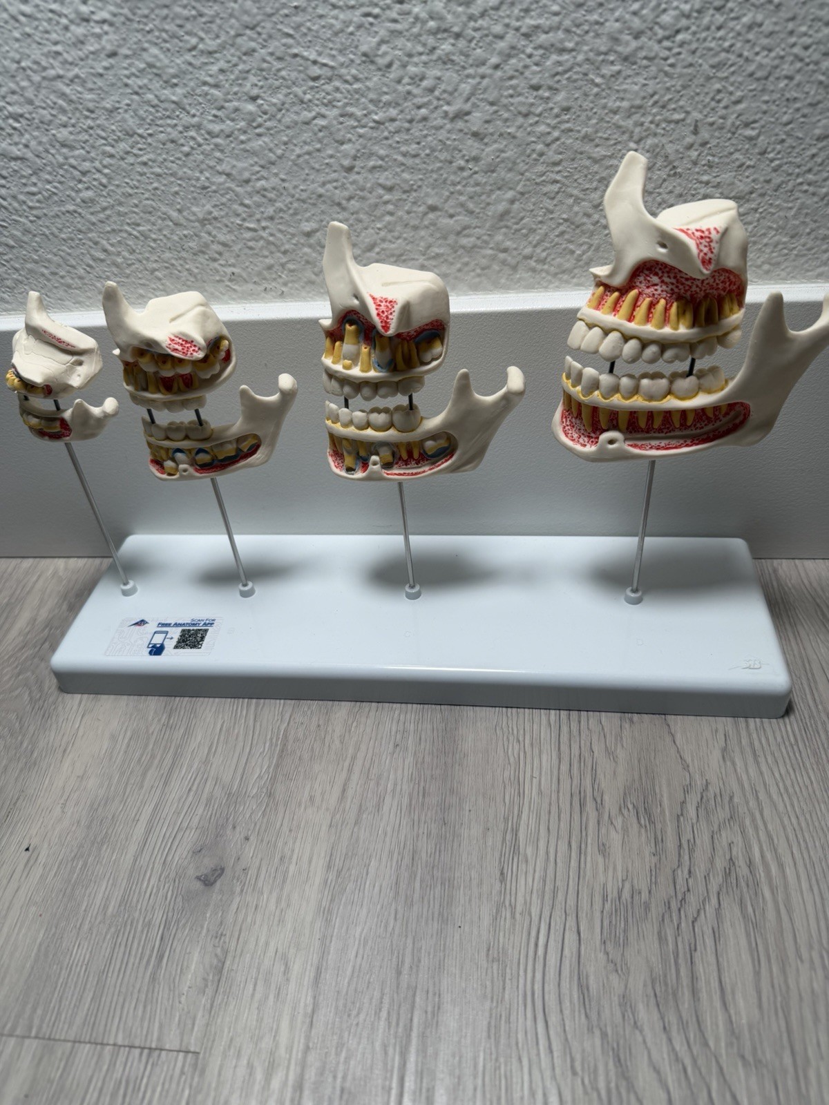 3B Scientific Dentition Development Model – 4 Stages Dental Teeth education