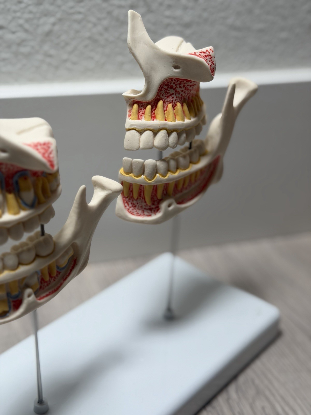 3B Scientific Dentition Development Model – 4 Stages Dental Teeth education