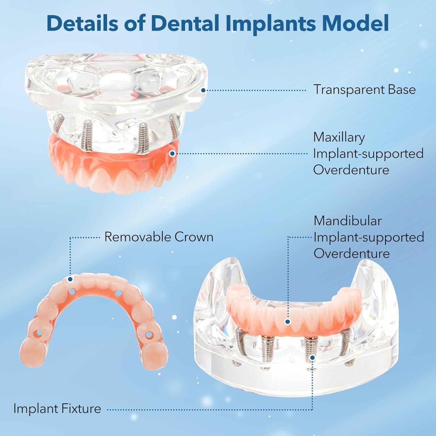Dental Implant All-on-4 Overdenture Treatment Model Upper/Lower 4 Implants Clear