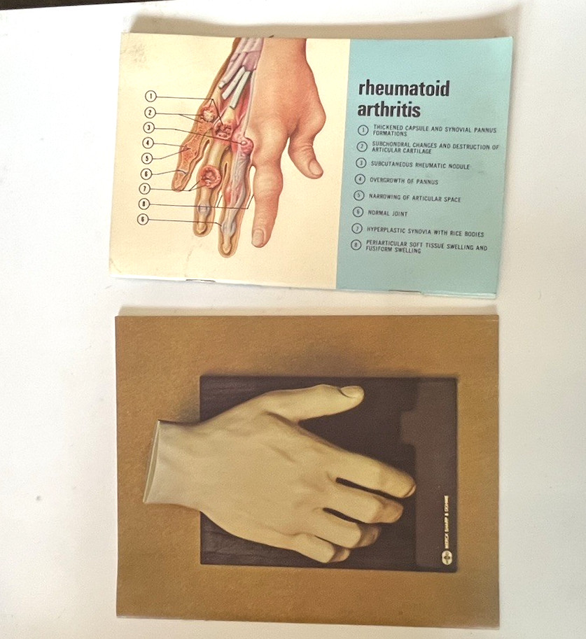 Vintage Merck Anatomical Medical Hand Model Indocin With Booklets 1967 Display