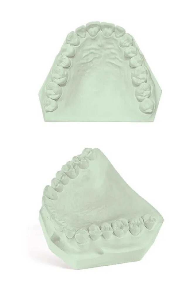DENTAL LAB GYPSUM DIE STONE TYPE IV GREEN ALL PURPOSE STRONG COMPOUND 5 Lbs.