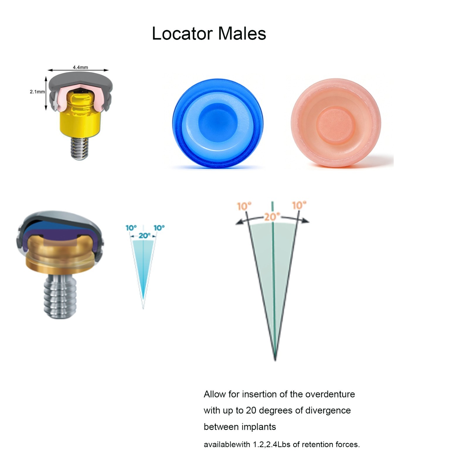 Dental Classic Locator Abutment Internal Hex ZEST Legacy Anchor For Hiossen ET