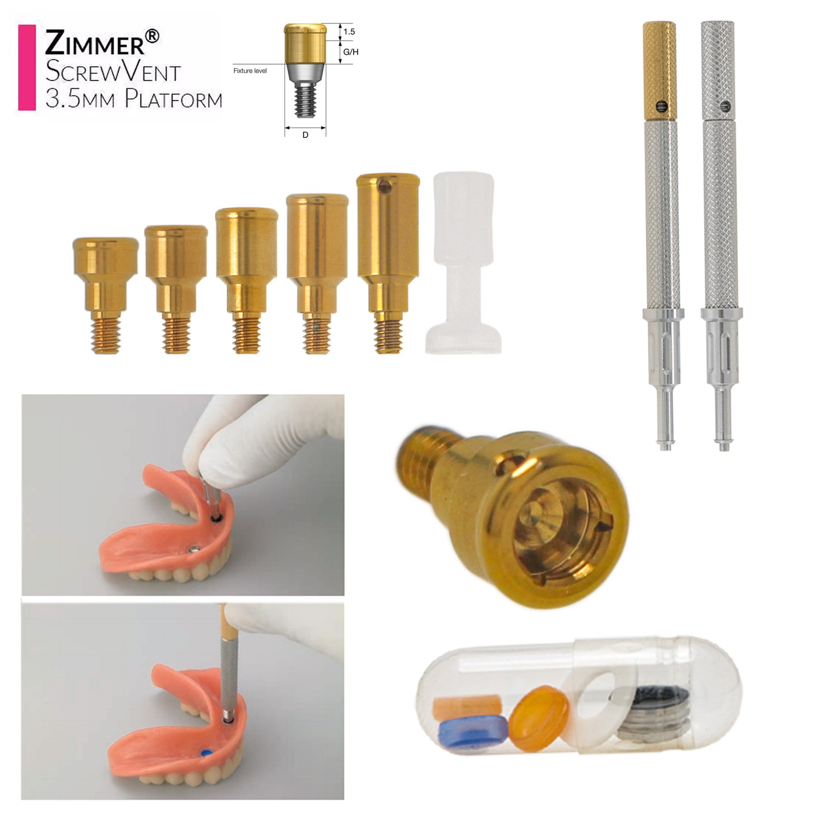 US Dental Locator Overdenture Abutment & Accessories Compatible Multiple Implant
