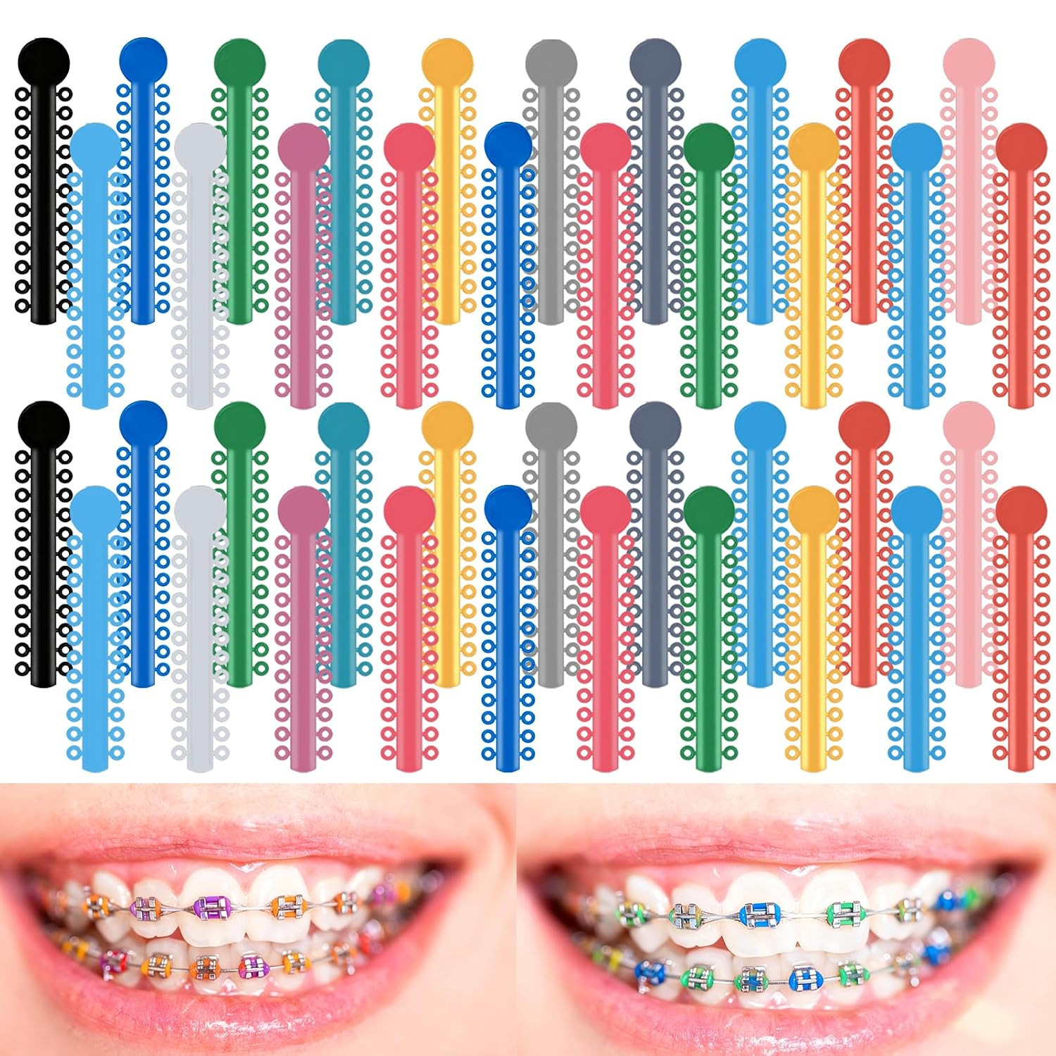 1040 Orthodontic Ligature Ties Multi Color Elastomeric O-Rings Braces Bands Kit