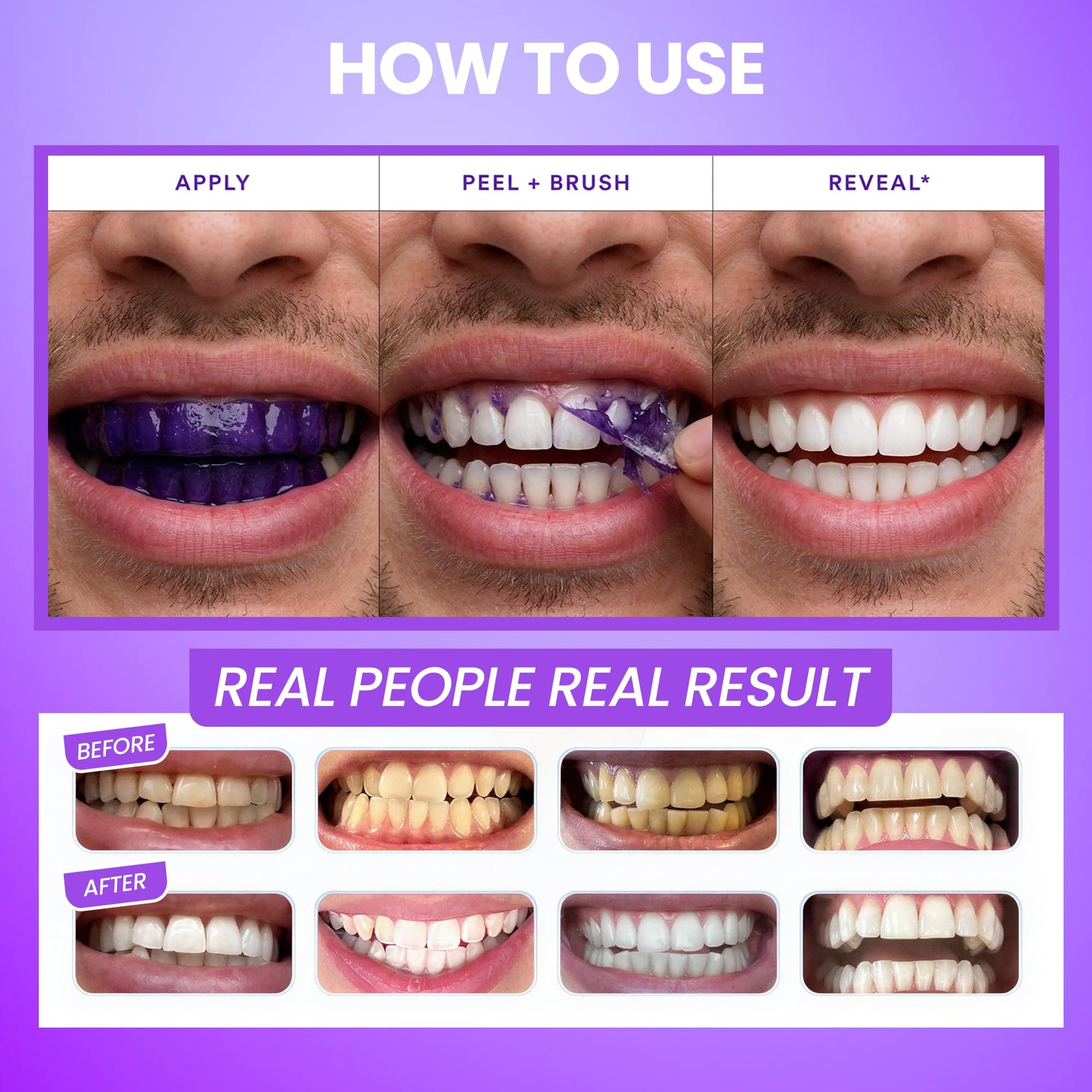 AFD Prime Purple Teeth Whitening Strips for 1 Count (Pack of 14),