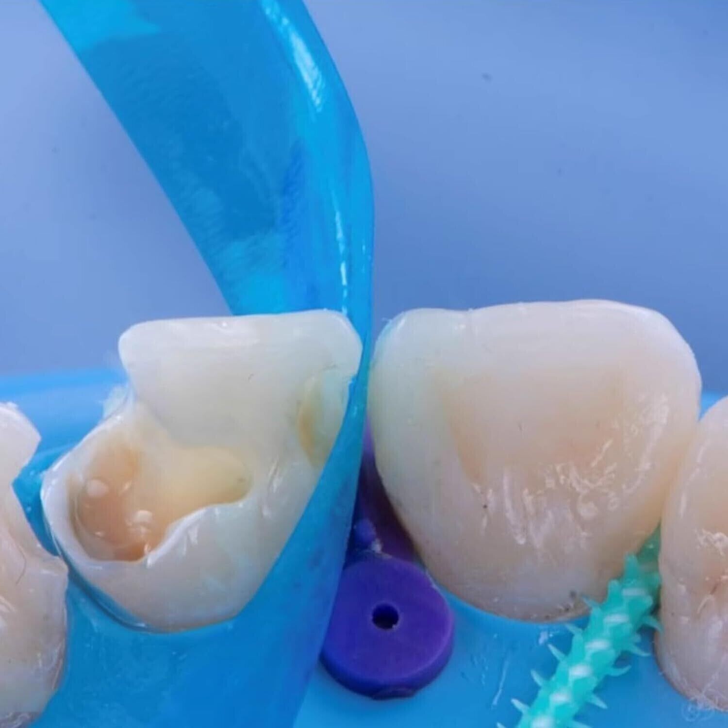 50 Pcs Dental Resin Matrices 0.05mm Matrix Bands Blue Strip Anterior Restoration