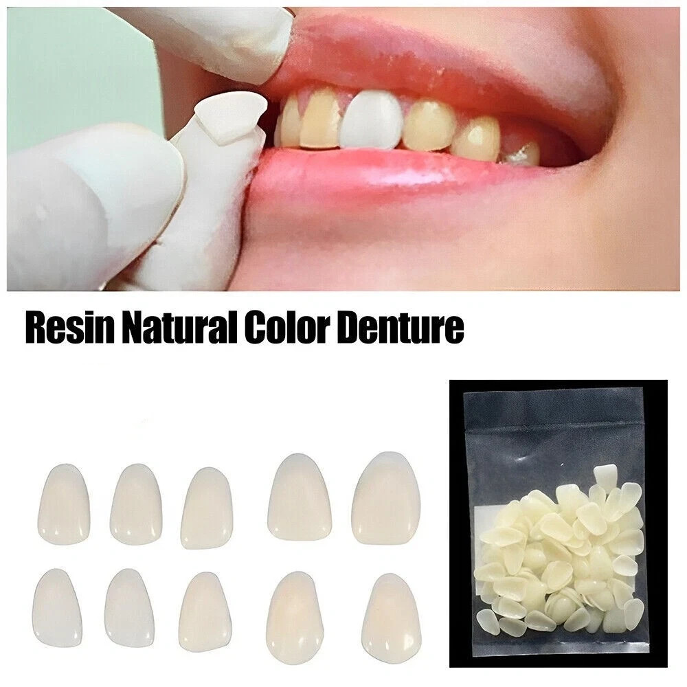 50Pcs Dental Temporary Crown Veneers for Anterior Teeth Whitening/Restoring